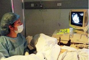 采卵视频,高清视频带你直击生命起源瞬间