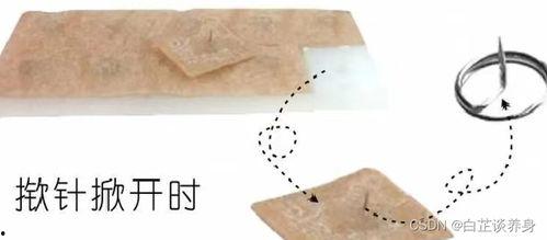 揿针使用视频,轻松掌握家庭养生新技能